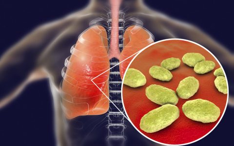 每日一题_2023.04.28