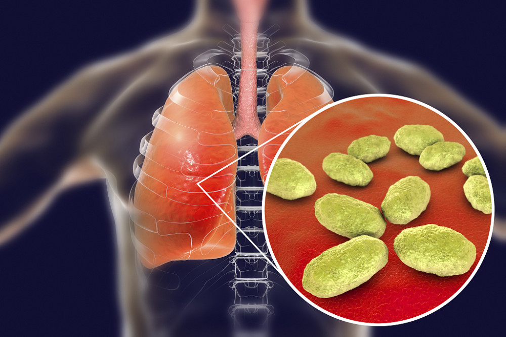 每日一题_2023.04.28