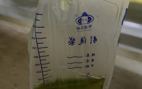尿液绿色