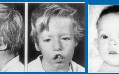 每日一题_2023.04.26