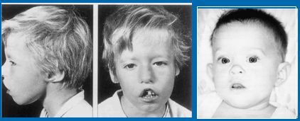 每日一题_2023.04.26