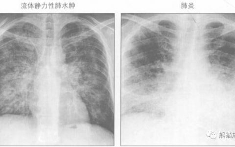 每日一题_2023.04.22