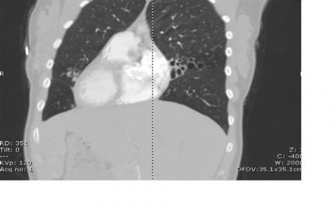 每日一题_2023.04.17
