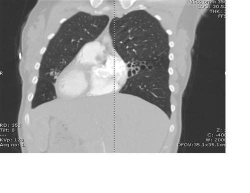 每日一题_2023.04.17