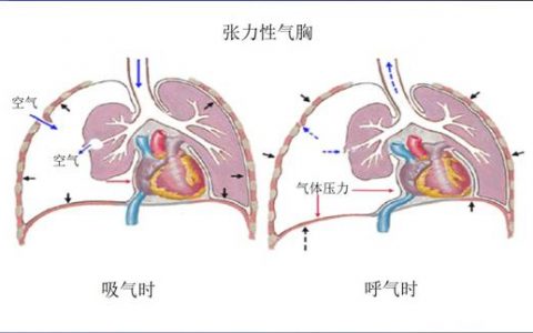 每日一题_2023.04.02