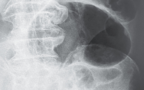 每日一题_2023.04.06