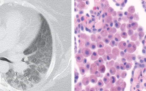 每日一题_2023.04.13