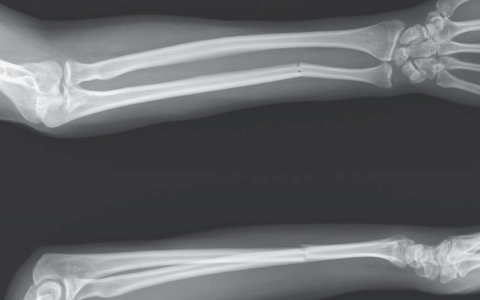 每日一题_2023.04.20