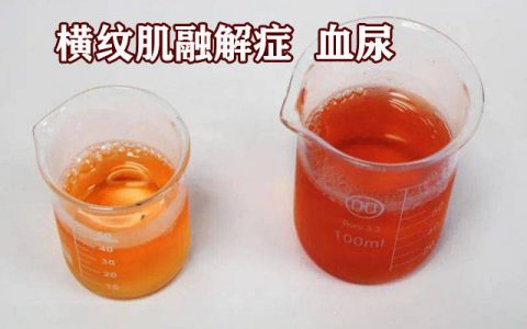 每日一题_2023.05.06