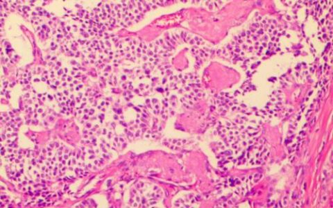 每日一题_2023.05.10