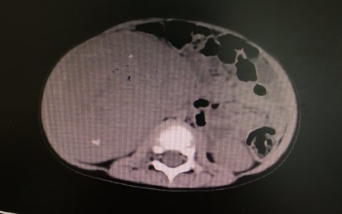 每日一题_2023.05.19