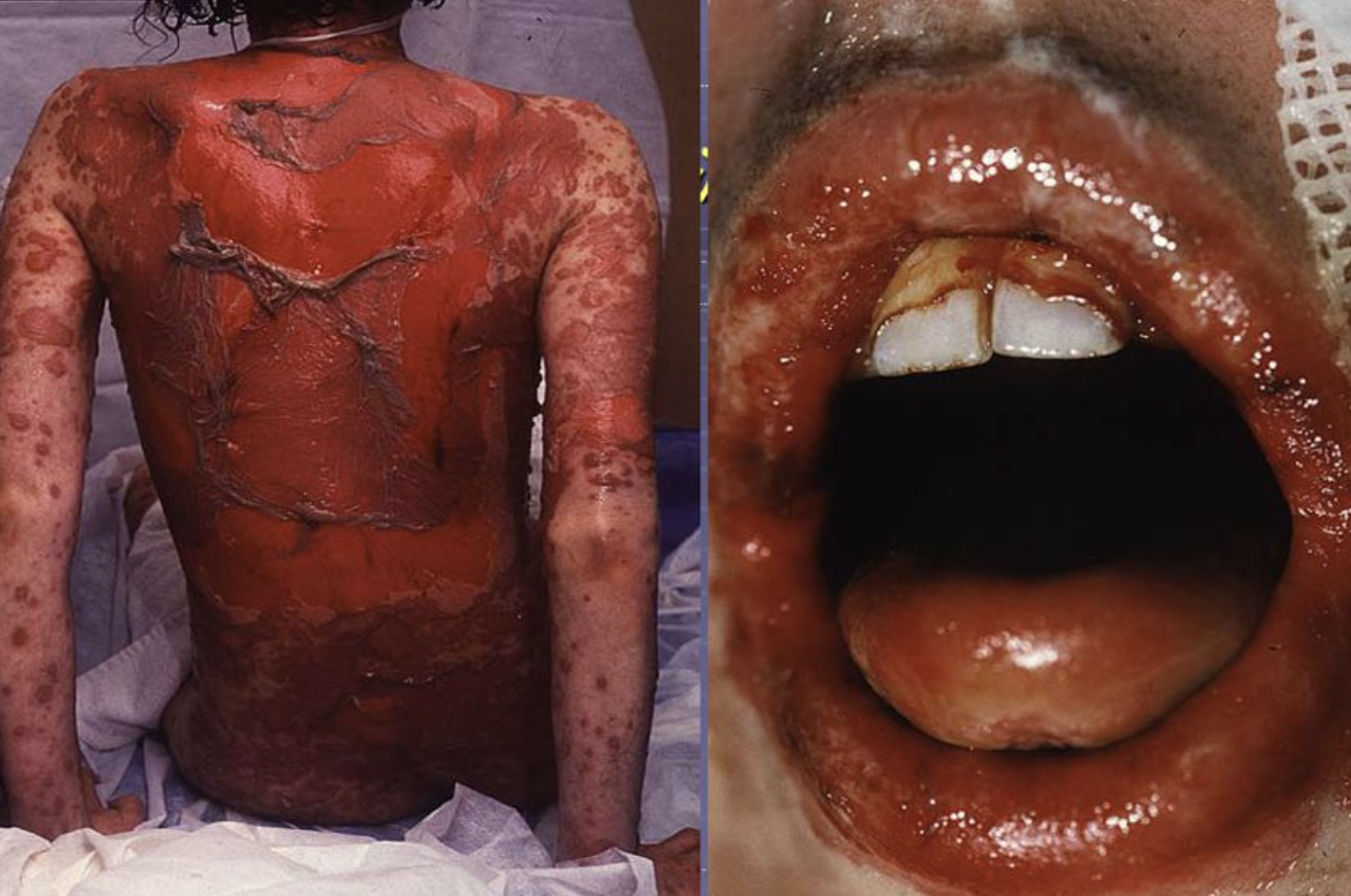 每日一题_2023.05.14