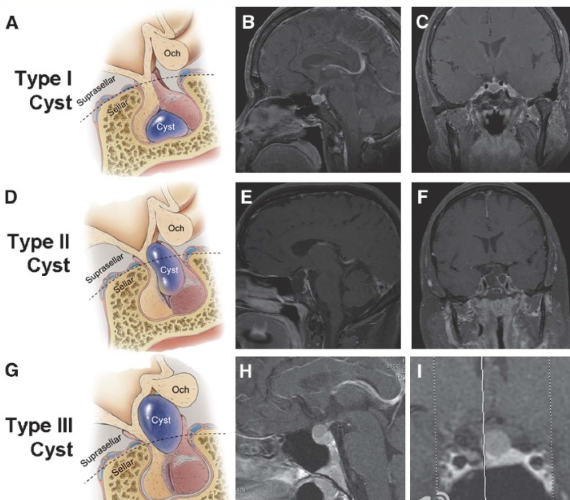每日一题_2023.05.24
