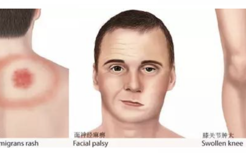 每日一题_2023.05.25