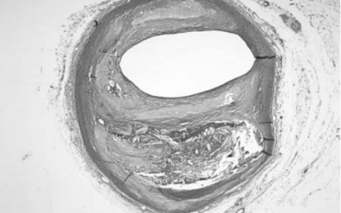 每日一题_2023.05.28