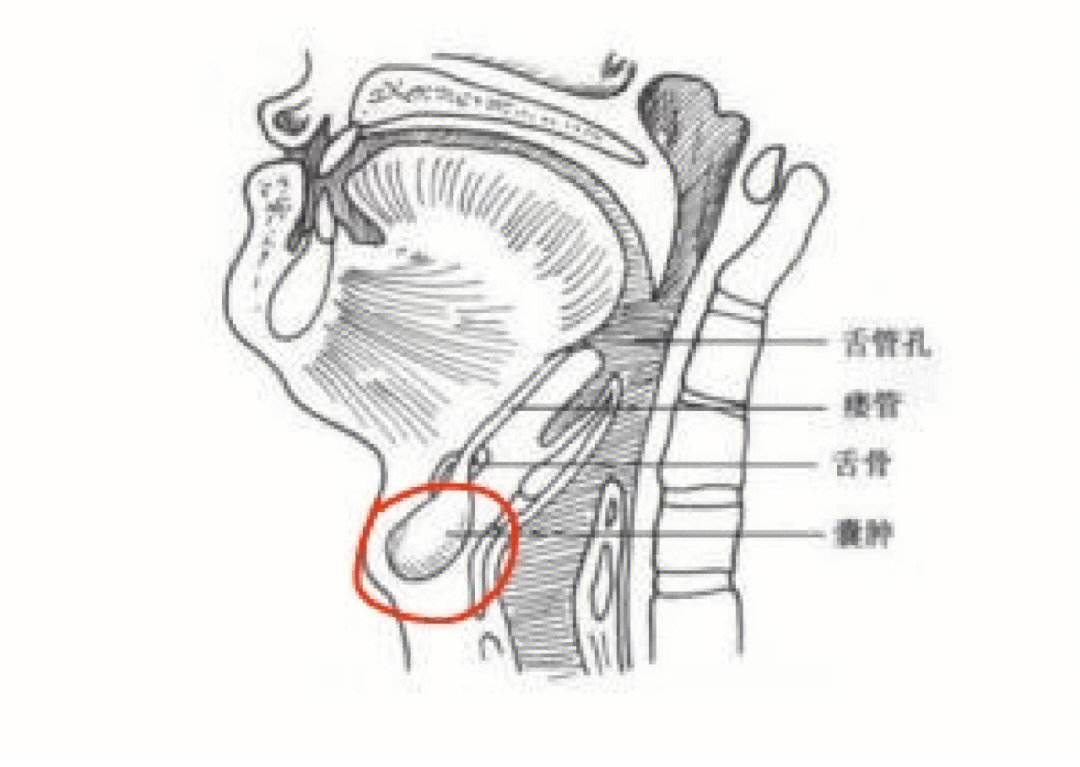 每日一题_2023.05.22