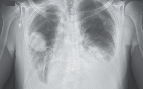 每日一题_2023.05.26