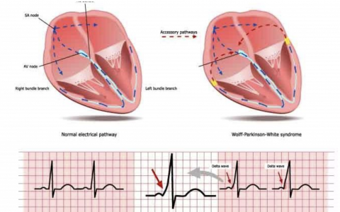 每日一题_2023.06.06