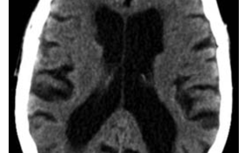 每日一题_2023.06.11