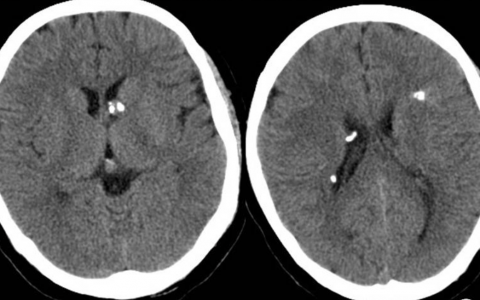 每日一题_2023.06.13