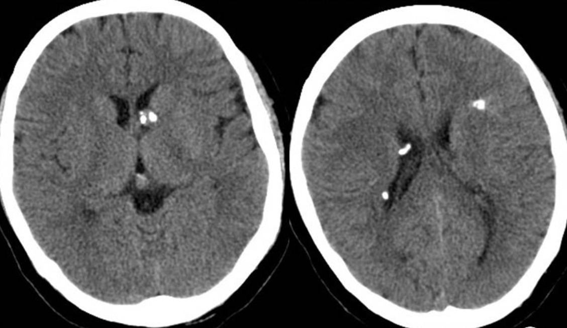 每日一题_2023.06.13