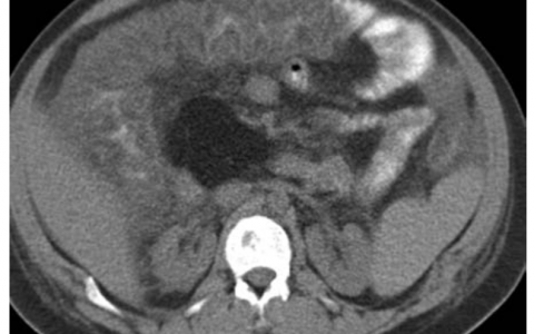 每日一题_2023.06.20
