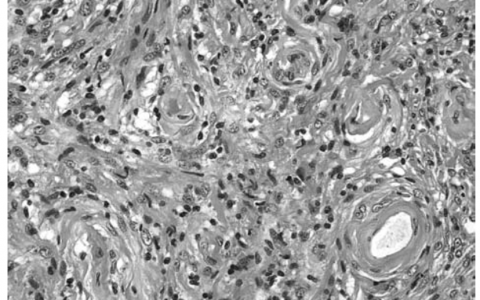 每日一题_2023.06.28