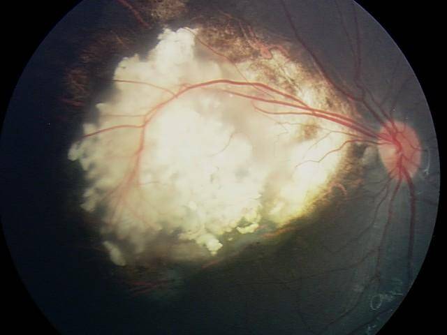 每日一题_2023.06.15