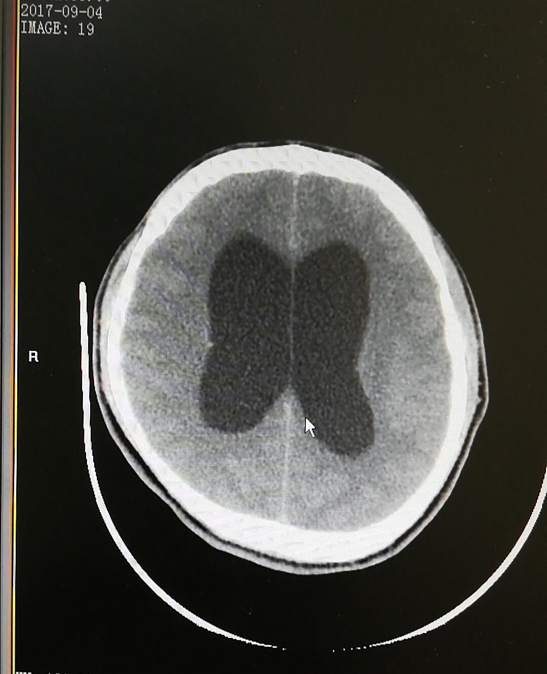 每日一题_2023.06.21