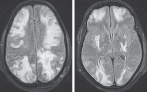 每日一题_2023.06.01