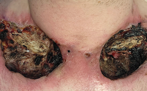 每日一题_2023.06.08