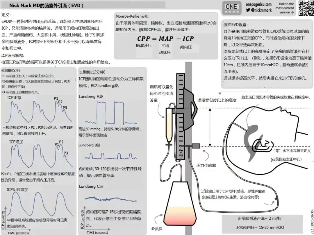 脑室外引流装置的应用图解