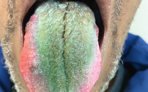 每日一题_2023.06.30