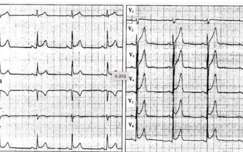 每日一题_2023.07.24