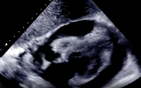 每日一题_2023.07.25