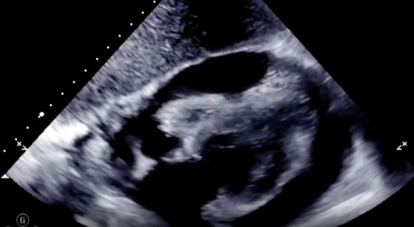 每日一题_2023.07.25