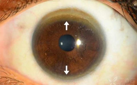 每日一题_2023.07.26