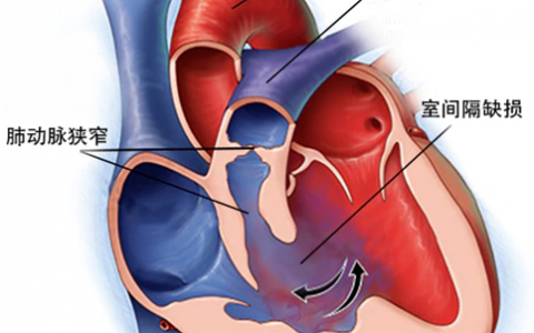 每日一题_2023.07.05