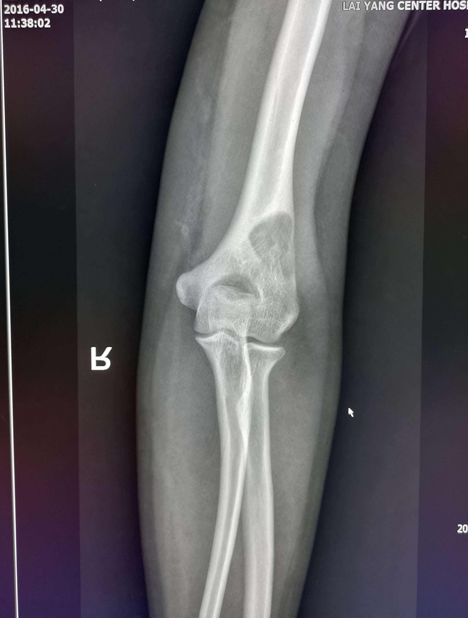 每日一题_2023.07.09