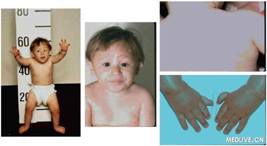 每日一题_2023.07.22