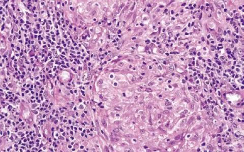 每日一题_2023.07.15