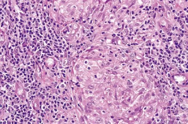 每日一题_2023.07.15