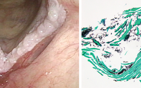 每日一题_2023.07.13