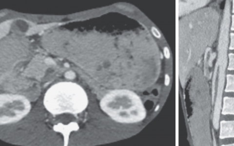 每日一题_2023.07.20