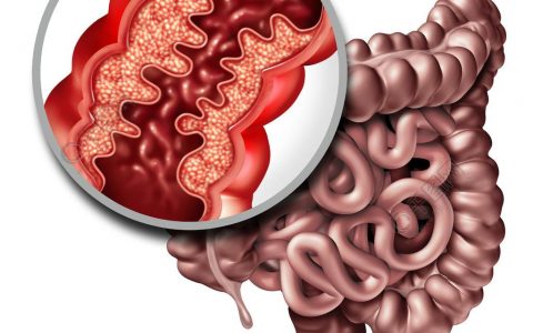 每日一题_2023.08.30