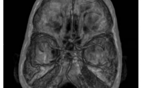 每日一题_2023.08.06