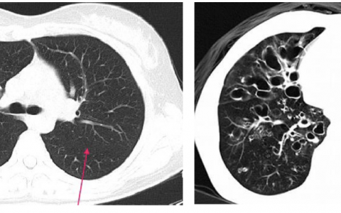 每日一题_2023.08.25