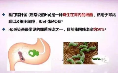 每日一题_2023.08.21