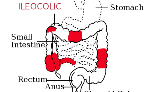 每日一题_2023.08.16