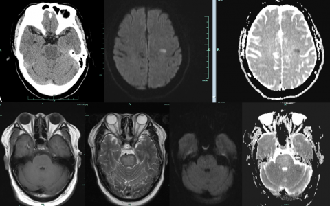 每日一题_2023.08.29